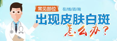 白癜风常识