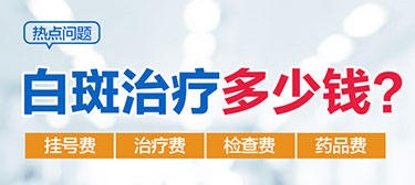 白癜风治疗